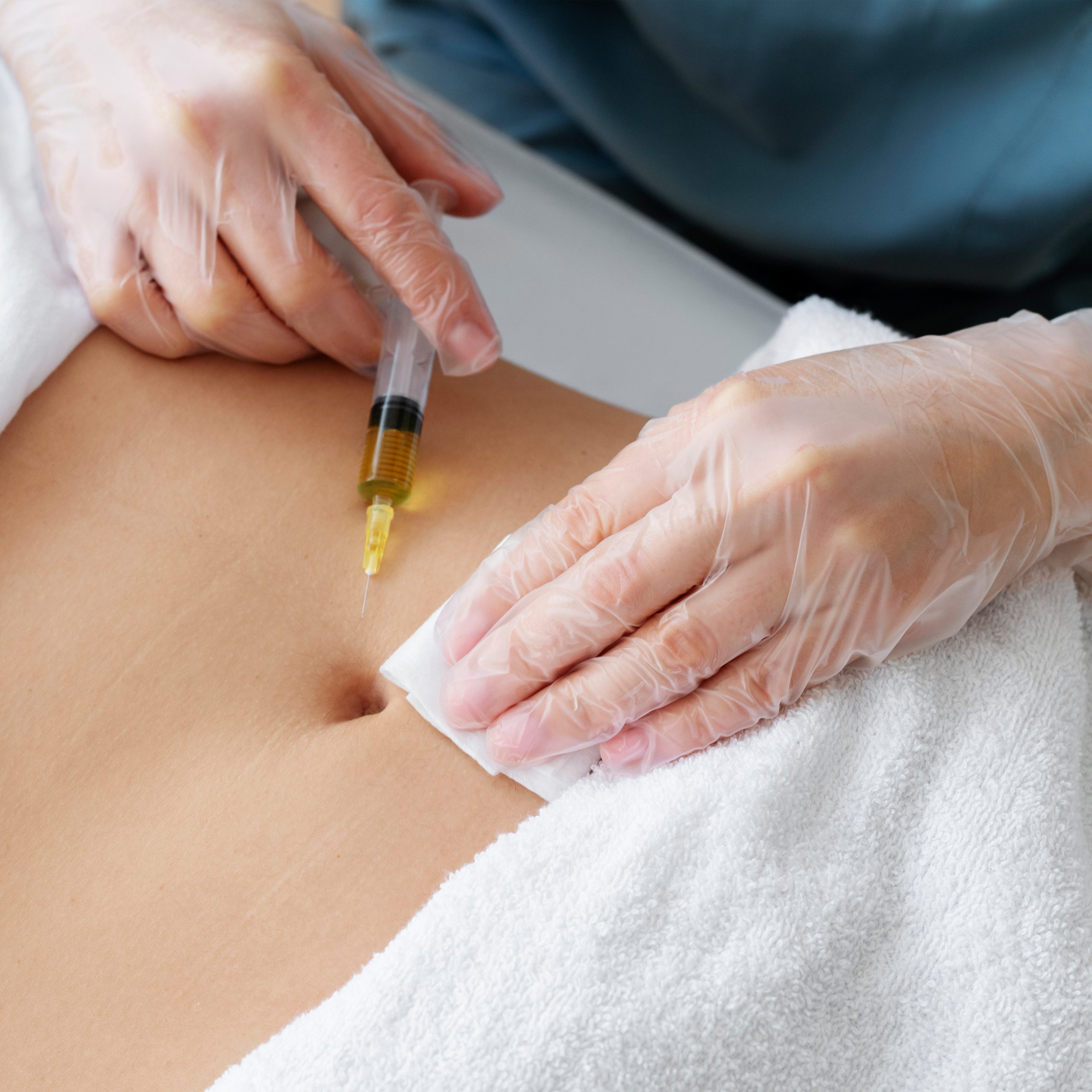 Mesoterapia